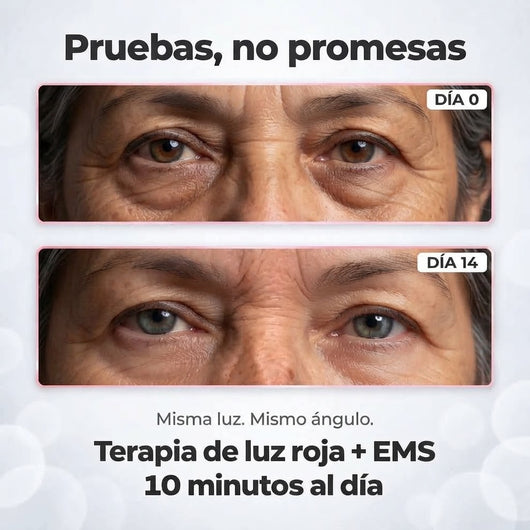 ReLumen® 2 en 1 Terapia de Luz Roja + EMS Para Eliminar las Bolsas de los Ojos