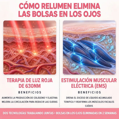 ReLumen® 2 en 1 Terapia de Luz Roja + EMS Para Eliminar las Bolsas de los Ojos